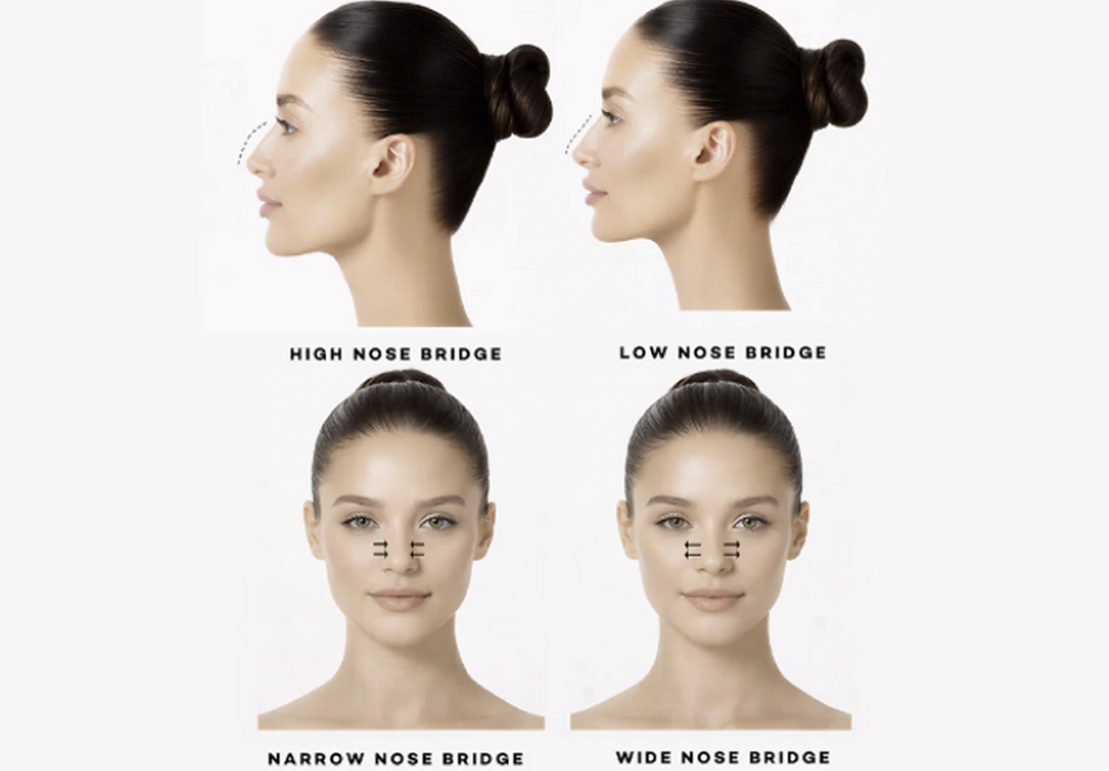 Analysing your Nose Bridge