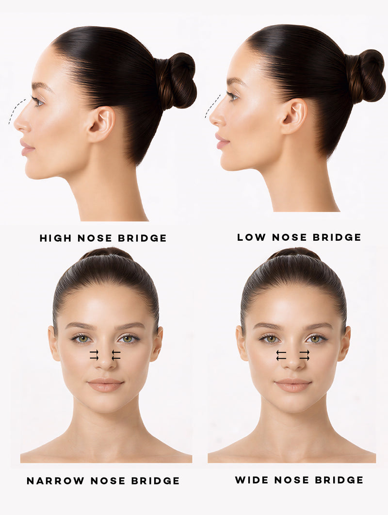Nose Bridge